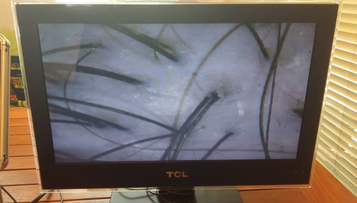 Ciri-Ciri Panel LCD TV Rusak
